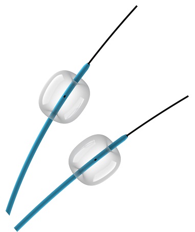 [사용설명서](수인 20-4607 호)담관결석제거용풍선카테터 : Stone Extraction Balloon